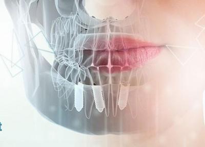 گفتگوی متفاوت با موسس کلینیک دندانپزشکی زیبادنت
