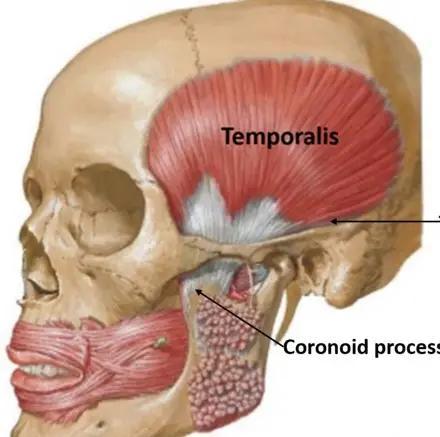 تحلیل عضله در این ناحیه کلیدی، خطر زوال عقل و آلزایمر را تا 60 درصد افزایش می دهد